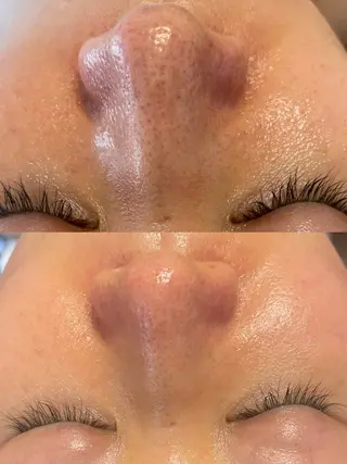 西区九条エステ MITUREIサロンのエステ・リラクイメージ