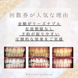 ホワイトニングショップ　四条店所属・ホワイトニング ショップ 四条店のエステ・リラクイメージ