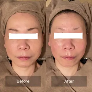 Ｂ&H所属・頭痛•肩こり専門/ 眉サロンB&H心斎橋のエステ・リラクイメージ