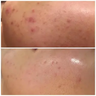 触れたくなる モテ肌へ...❤︎のエステ・リラクイメージ