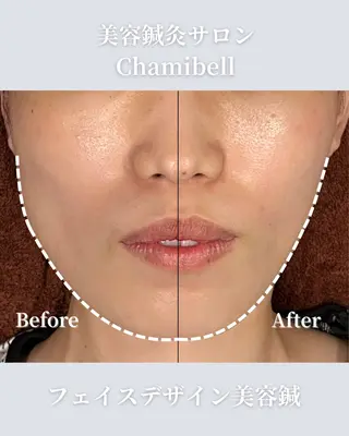 美容鍼灸サロン Chamibelleのエステ・リラクイメージ