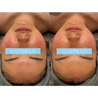 ☆痩身/小顔☆ 結果出します☆のエステ・リラクイメージ