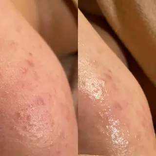 Mandarin Orange所属・毛穴から始める肌メン テマンダリンオレンジのエステ・リラクイメージ