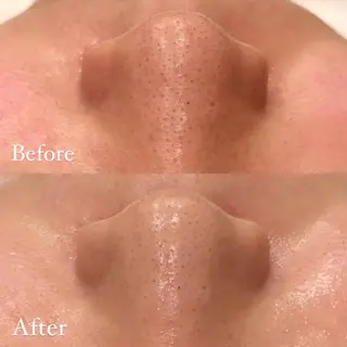 Hari Lounge恵比寿所属・chika🦋 ハリラウンジ恵比寿のエステ・リラクイメージ