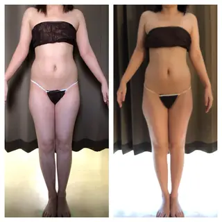 小顔・痩身専門店 Sunao所属・小顔.足痩せ整体 痩身天六Sunaoのその他イメージ