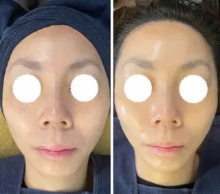 耳ツボ/体質改善/ 温活La mer月島のその他イメージ