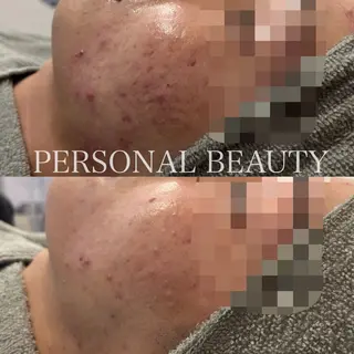 PERSONAL BEAUTY🪻のエステ・リラクイメージ