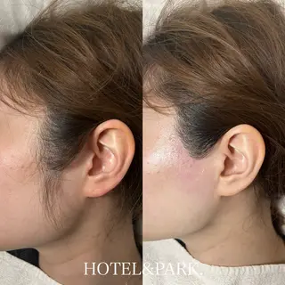 HOTEL&PARK .Moeワックス脱毛のエステ・リラクイメージ