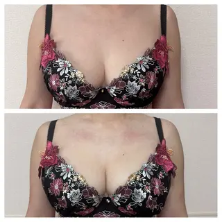 Miel所属・バストアップサロン Mielのエステ・リラクイメージ