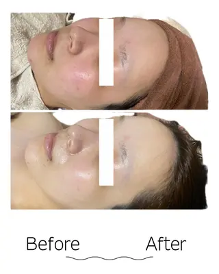 Linoa所属・Linoa（リノア） エステ&リラクのエステ・リラクイメージ