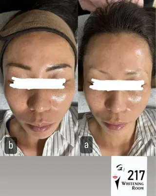 217whitening  room所属・217 ホワイトニングルームのエステ・リラクイメージ