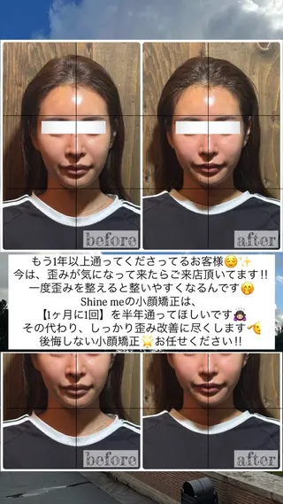 💎後悔させない小顔 矯正💎イトヤマ🌱のエステ・リラクイメージ