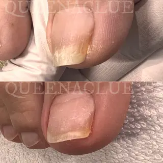 ネイル 毛穴改善/脱毛 ネイル 川上久仁子のエステ・リラクイメージ