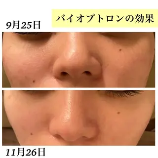 Bellesthe (ベルエステ)のエステ・リラクイメージ