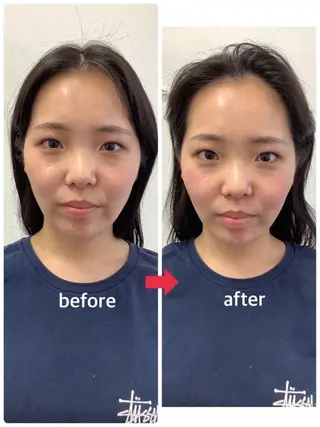 メディカルサロンドオフ所属・ハリサロンドオフ 美容鍼灸×小顔整体のエステ・リラクイメージ