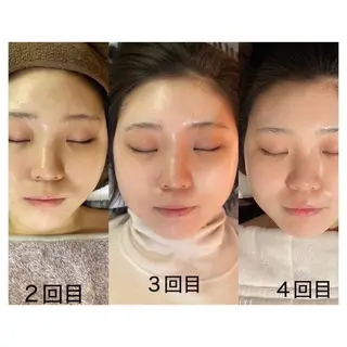 NiU.BEAUTY 新宿のエステ・リラクイメージ