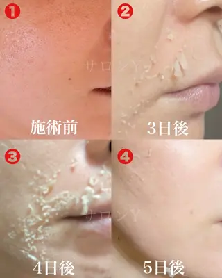 グリーンピール専門店 サロンY【大阪】のエステ・リラクイメージ