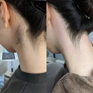 Morphome所属・【Morphome】 hinaのエステ・リラクイメージ