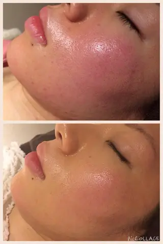 セミロング カラー パーマ ヘアアレンジ メンズ キッズ ネイル マツエク・マツパ アニメ,Vオタク× 即効痩せエステサロンのエステ・リラクイメージ