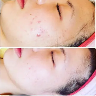 FLEUR大阪・美容 整体・痩身・小顔のエステ・リラクイメージ