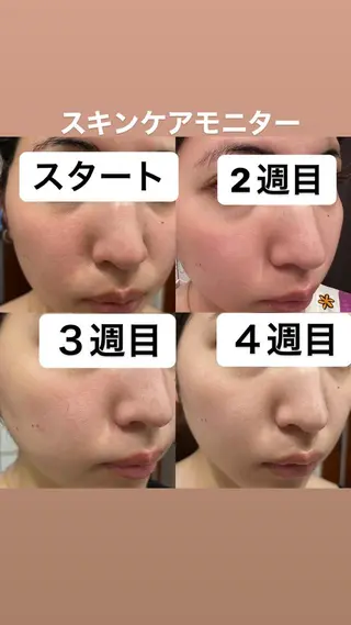 Shiny所属・✨ナリス化粧品✨ Shinyのエステ・リラクイメージ
