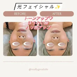 プライベートサロン宿り木所属・江坂@宿り木　脱毛＆ 耳ツボジュエリーのその他イメージ