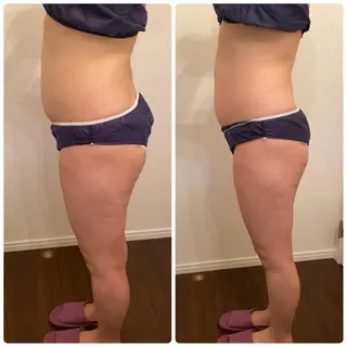 FLEUR大阪・美容 整体・痩身・小顔のエステ・リラクイメージ