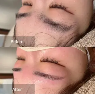 アイブロウ for woman所属・森 美優のエステ・リラクイメージ