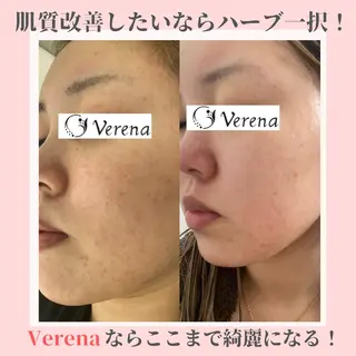 ピーリング専門店 Belluteのエステ・リラクイメージ