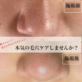eyelashsalon Plaisir所属・ツカハラ ミカのエステ・リラクイメージ