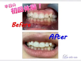 セルフホワイトニングサロン　ラヴィアン所属・ホワイトニングサロン La vie enのその他イメージ