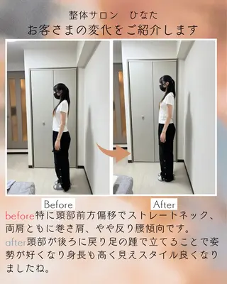 整体サロン　ひなた~HINATA~ 　京阪七条　京都店所属・肩こり反り腰改善専門 筋膜✨整体ひなたのエステ・リラクイメージ