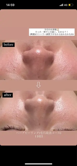 Amv. mananoのエステ・リラクイメージ