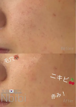 韓国🇰🇷価格 サロン_Nbibiのエステ・リラクイメージ