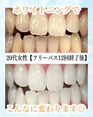 メンズ キッズ ホワイトニング専門店 WHITE天神店のエステ・リラクイメージ