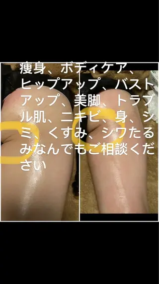 トータルビューティ美麗所属・トータルビューティ 美麗のエステ・リラクイメージ