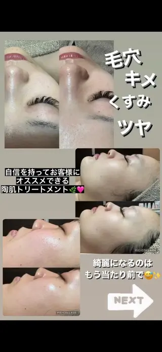 エステ✖️ネイル Feelのネイルデザイン