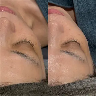 LiZA エステティックサロンのエステ・リラクイメージ