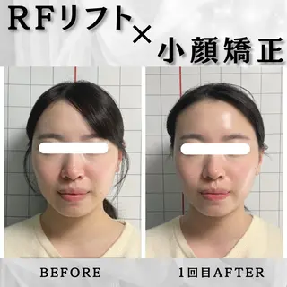 小顔矯正専門店 ❤️池田 桃花のエステ・リラクイメージ