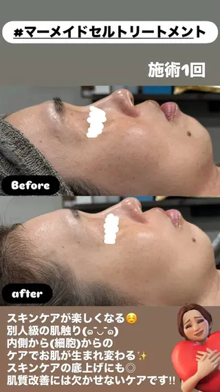 LiZA エステティックサロンのエステ・リラクイメージ