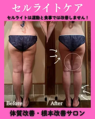 痩身&美肌サロン 堀米✨のエステ・リラクイメージ