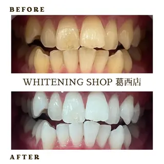 キッズ メンズ ホワイトニング ショップ葛西店のその他イメージ