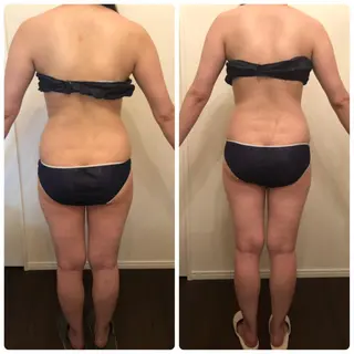 FLEUR大阪・美容 整体・痩身・小顔のエステ・リラクイメージ