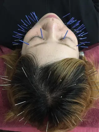 美容鍼灸女性専用 りんご鍼灸治療院のその他イメージ