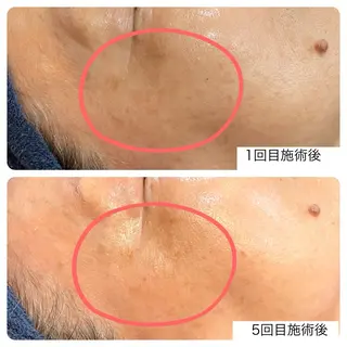 leolo武蔵浦和 肌質改善&脱毛のエステ・リラクイメージ