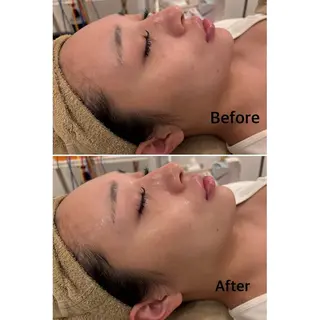 鍼灸サロン mahorobaトモのエステ・リラクイメージ