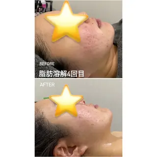 毛穴洗浄・痩身・脱毛 /アルカンジュのエステ・リラクイメージ