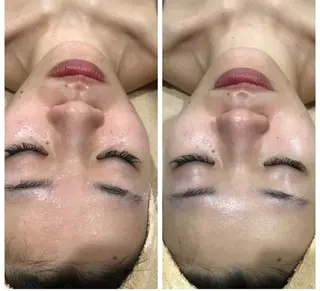 産後/ツヤ肌/子連れ /保育士在籍サロンのエステ・リラクイメージ