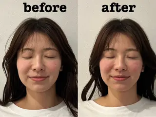 美容鍼灸Solana所属・小櫻 唯のエステ・リラクイメージ