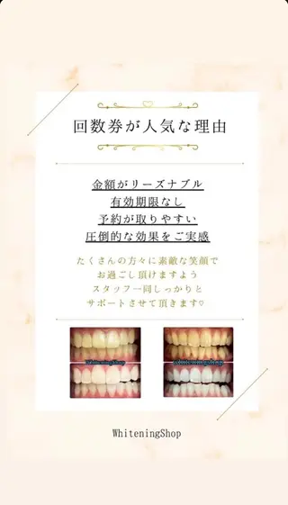 ホワイトニングショップ伊丹店所属・ホワイトニング ショップ伊丹店のその他イメージ